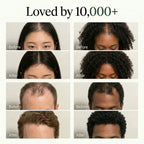 Korean Scalp Revival Bar